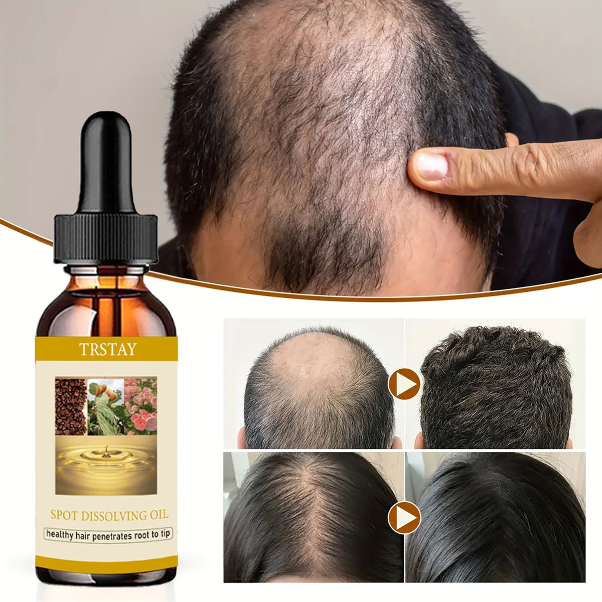 50ml óleo de crescimento de ba - Beard Oil avaliação e preço