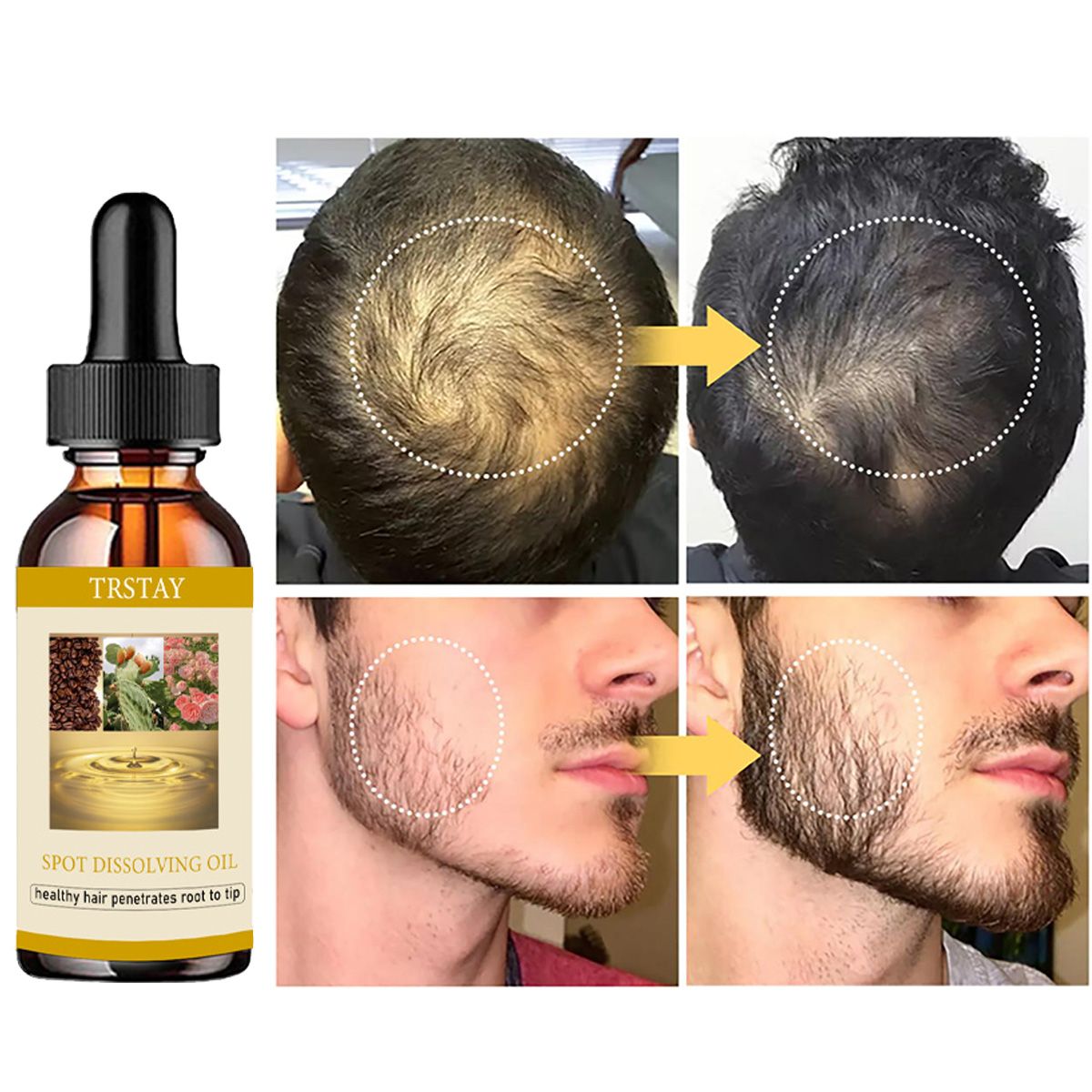 50ml óleo de crescimento de ba - Beard Oil avaliação e preço